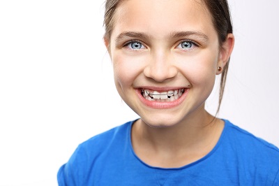 a kid smiling with braces