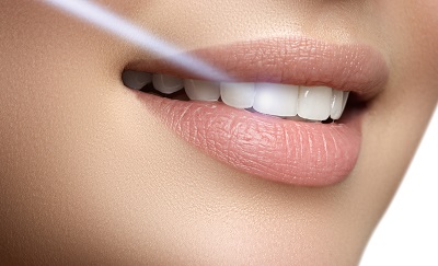 a closeup of a smile
