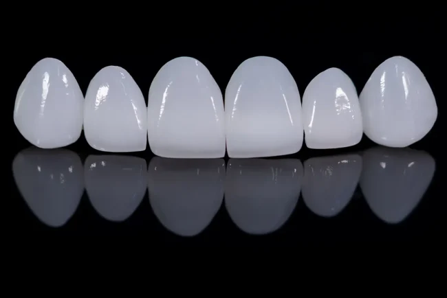 Do You Have To Brush Veneers?