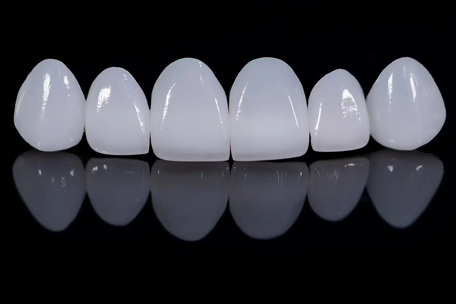Do You Have To Brush Veneers?