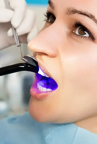 Dental Bonding 1